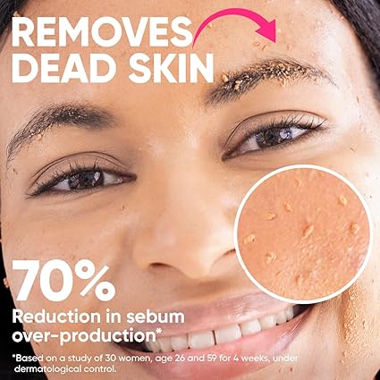 Ame Pure Peel So Good Chemical Peel – 120 ml Gentle Exfoliating Peeling Gel – Chemical Peel For Face - Reveals Radiant Skin - Chemical Exfoliant For Skin Rejuvenation- Transform Your Skin Today!